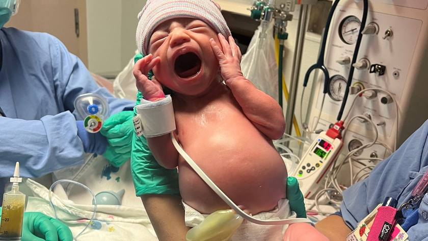  Ariya cries after her delivery, her distended abdomen obvious.