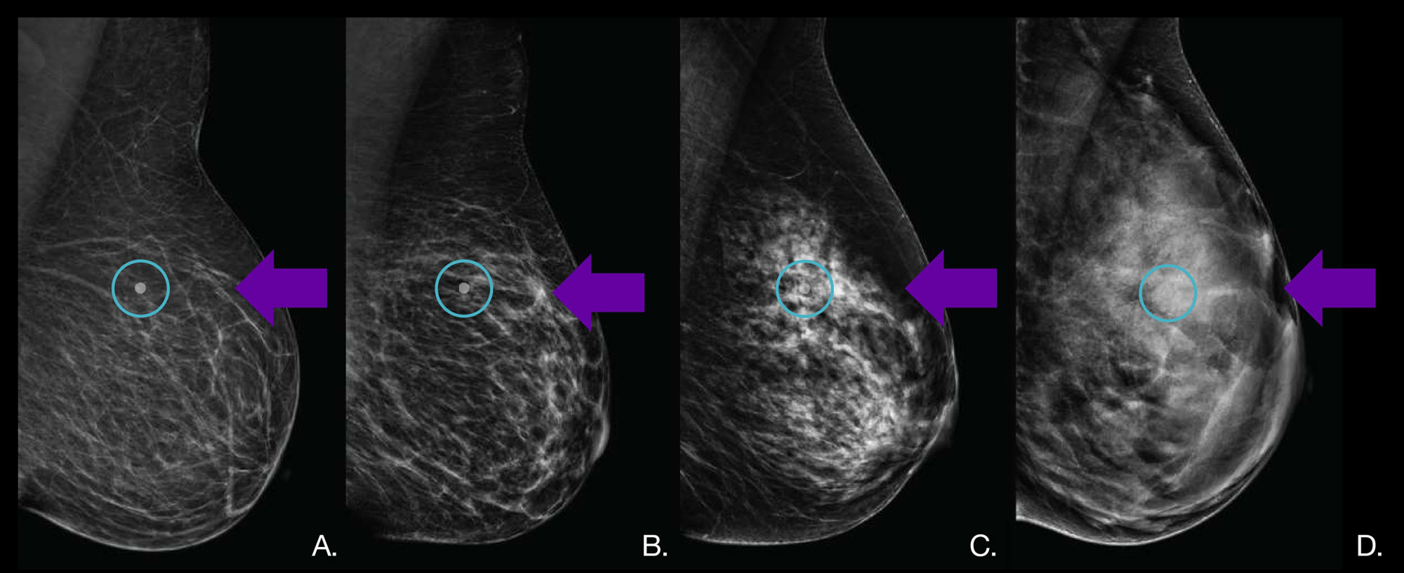 Ultrasounds displaying a range of hypothetical cancer densities