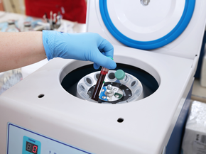 Tube of blood is placed in a medical centrifuge for plasma lifting