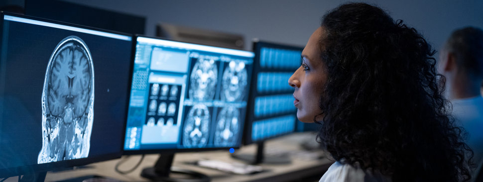 Doctor looks at imaging of the brain