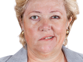 woman experiencing face paralysis