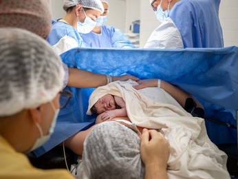 Team performing a cesarean section in the operating room, mother and baby too