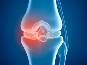 Knee problem, x-ray view