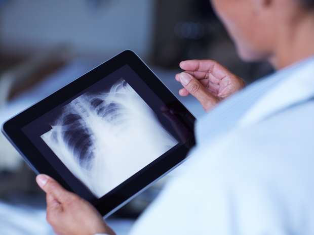 Doctor with X-ray on tablet
