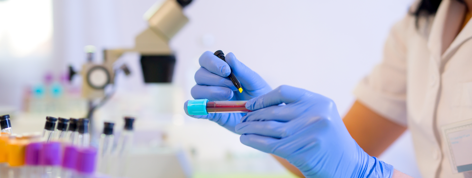 Provider writing on test tube