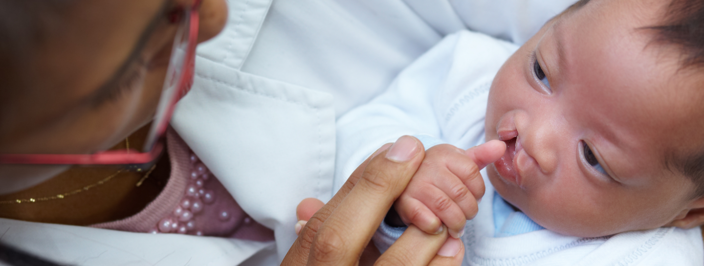 A woman looks down at a baby with a cleft lip in her arms
