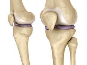 Medically accurate 3D illustration of knee anatomy