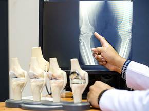 Doctor pointing on the knee problem point on x-ray film.