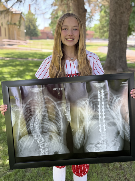 Patient standing outside with her X-rays.