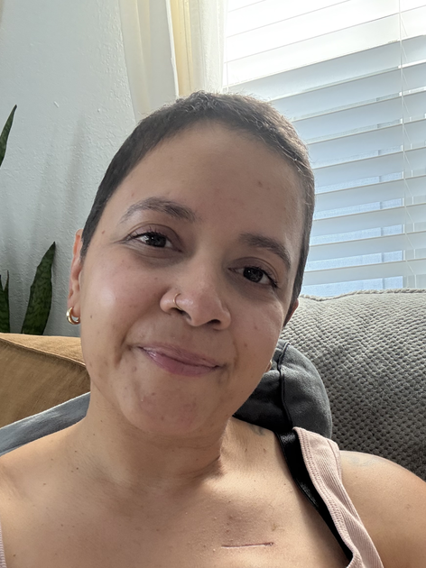 Jones during Chemotherapy treatment