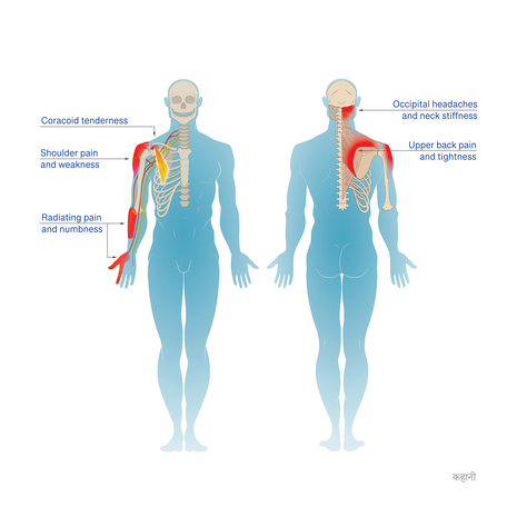 Medical Illustration