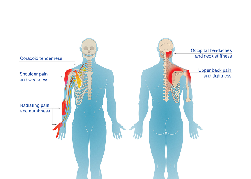 Medical Illustration
