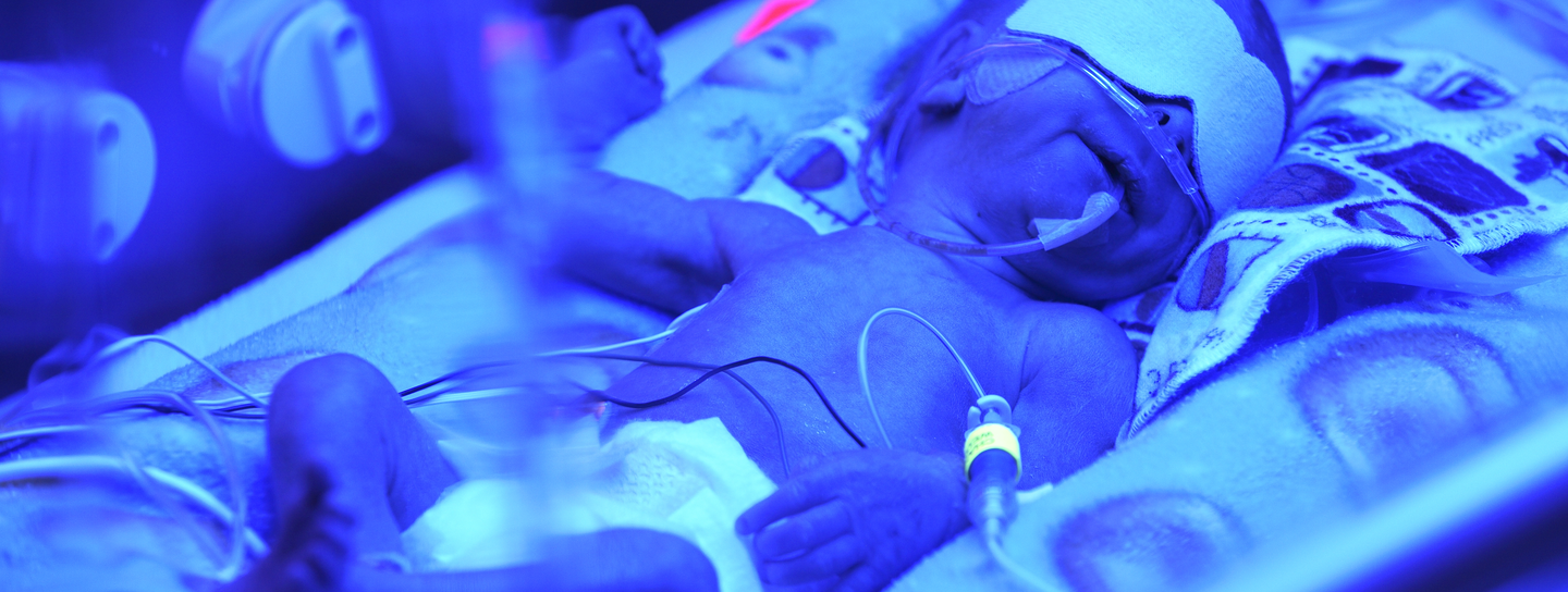 A NICU baby under blue light