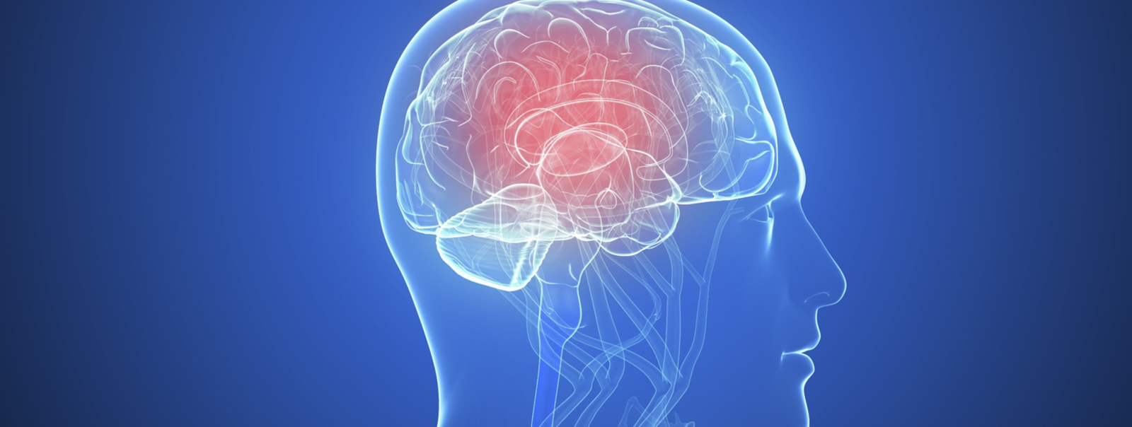 Image of an injured brain.