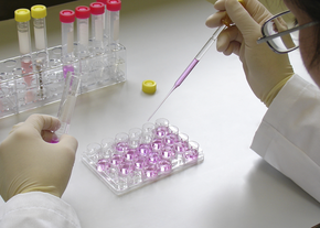 A hand uses a pipette to put liquid in small containers