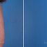 Breast reconstruction surgery before and after photos, left 90-degree angle view