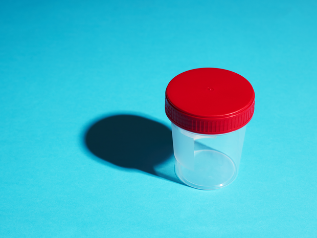 Specimen jar